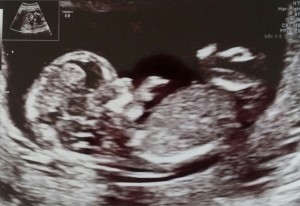 Første billede af Babylil